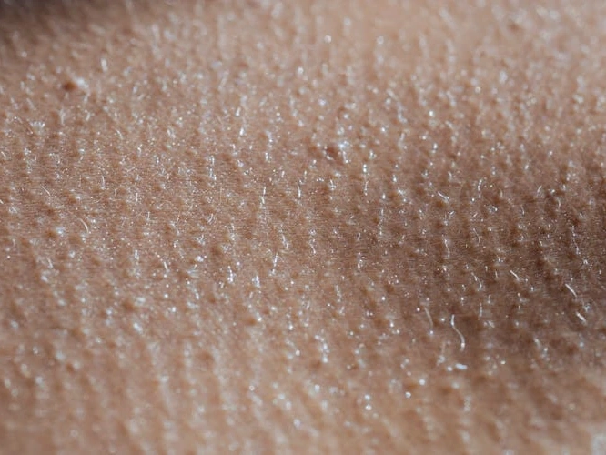 rough skin texture